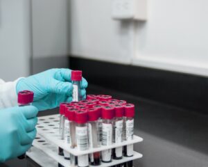 Florence woman in quarantine after hantavirus exposure