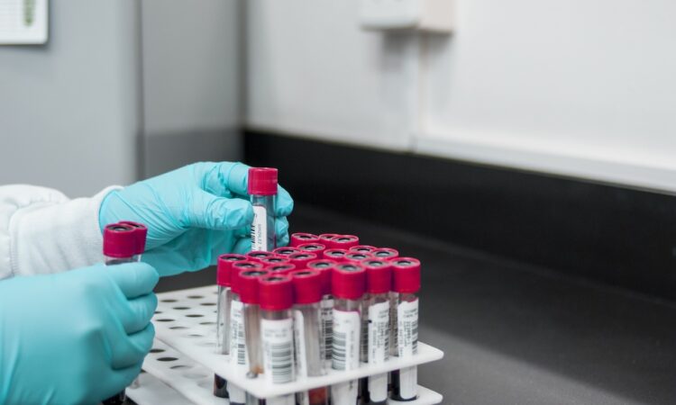 Florence woman in quarantine after hantavirus exposure